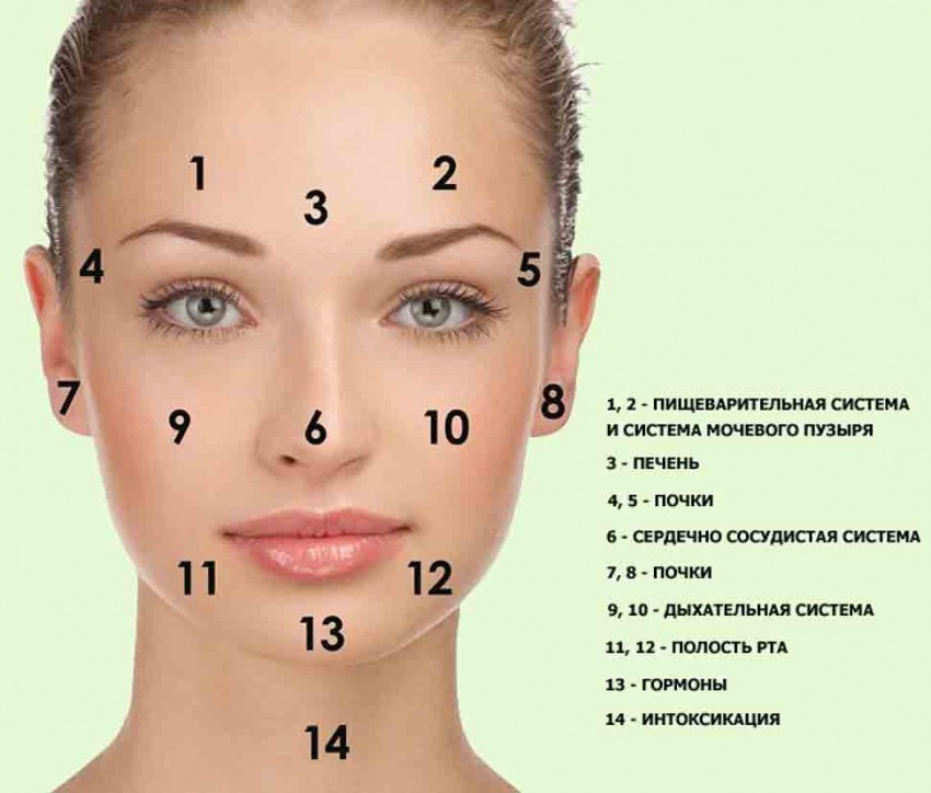 Прыщи на лбу: причины появления, основные виды, медикаментозное и косметологическое лечение (125 фото и видео)