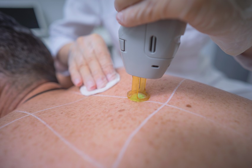 Прыщи на спине: причины появления и способы избавления. 120 фото лучших средств и видео описание видов прыщей